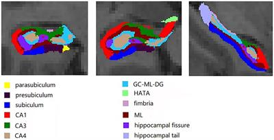 Machine learning classifiers and associations of cognitive performance with hippocampal subfields in amnestic mild cognitive impairment